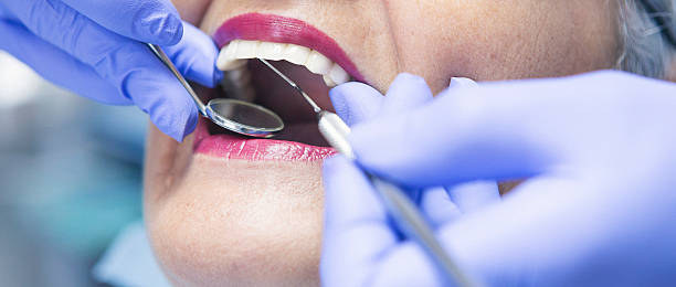 Best Emergency Dental Care for Broken or Chipped Teeth in Speedway, IN